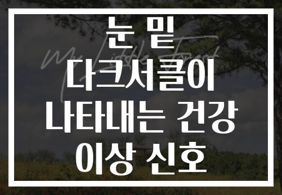 눈 밑 다크서클이 나타내는 건강 이상 신호