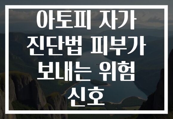 아토피 자가 진단법 피부가 보내는 위험 신호