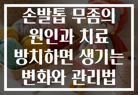손발톱 무좀의 원인과 치료 방치하면 생기는 변화와 관리법 손발톱 무좀의 원인과 치료 방치하면 생기는 변화와 관리법