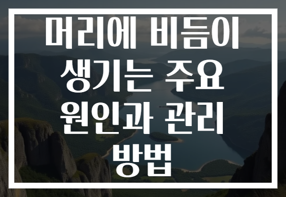 머리에 비듬이 생기는 주요 원인과 관리 방법