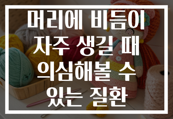 머리에 비듬이 자주 생길 때 의심해볼 수 있는 질환 머리에 비듬이 자주 생길 때 의심해볼 수 있는 질환